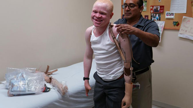 Albino ljudi i praznovjerja u Africi