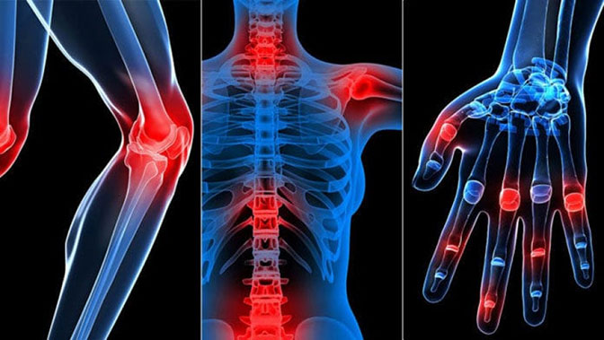 simptomi slabost mišića i bolova u zglobovima